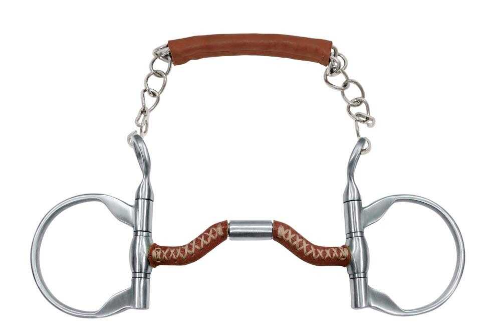 METALAB Spanish Dentures - Francois Gauthier