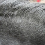 ANIMADERM Repellent - DERFLY™ - Image 4